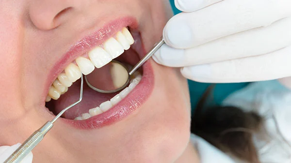 Dental instruments