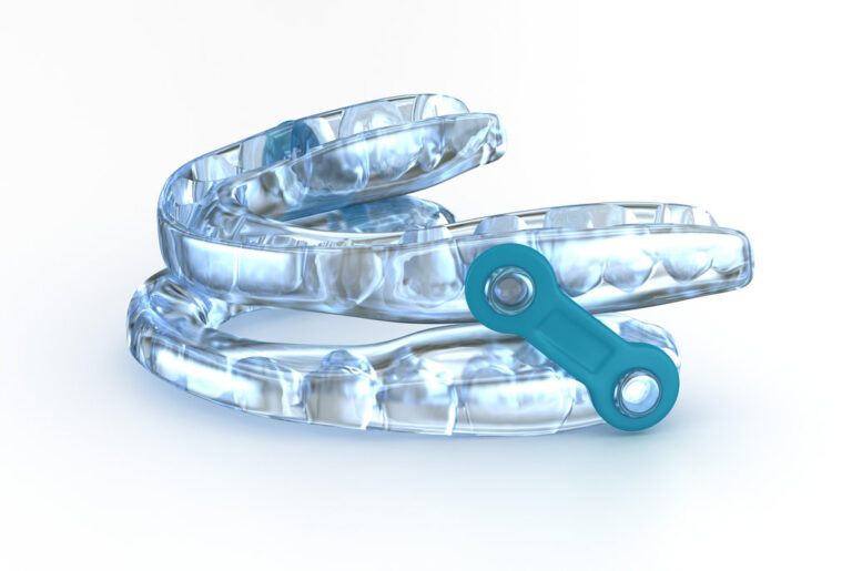 Oral appliance therapy device, sleep apnea treatment. 3D illustration