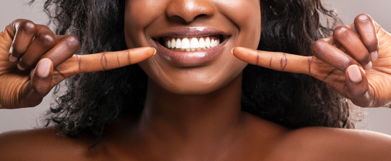 Orthodontic concept. Unrecognizable african american girl pointing at her healthy white teeth and widely smiling, panorama
