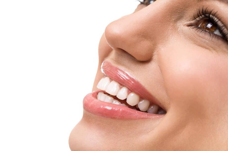 Are Dental Veneers Worth It