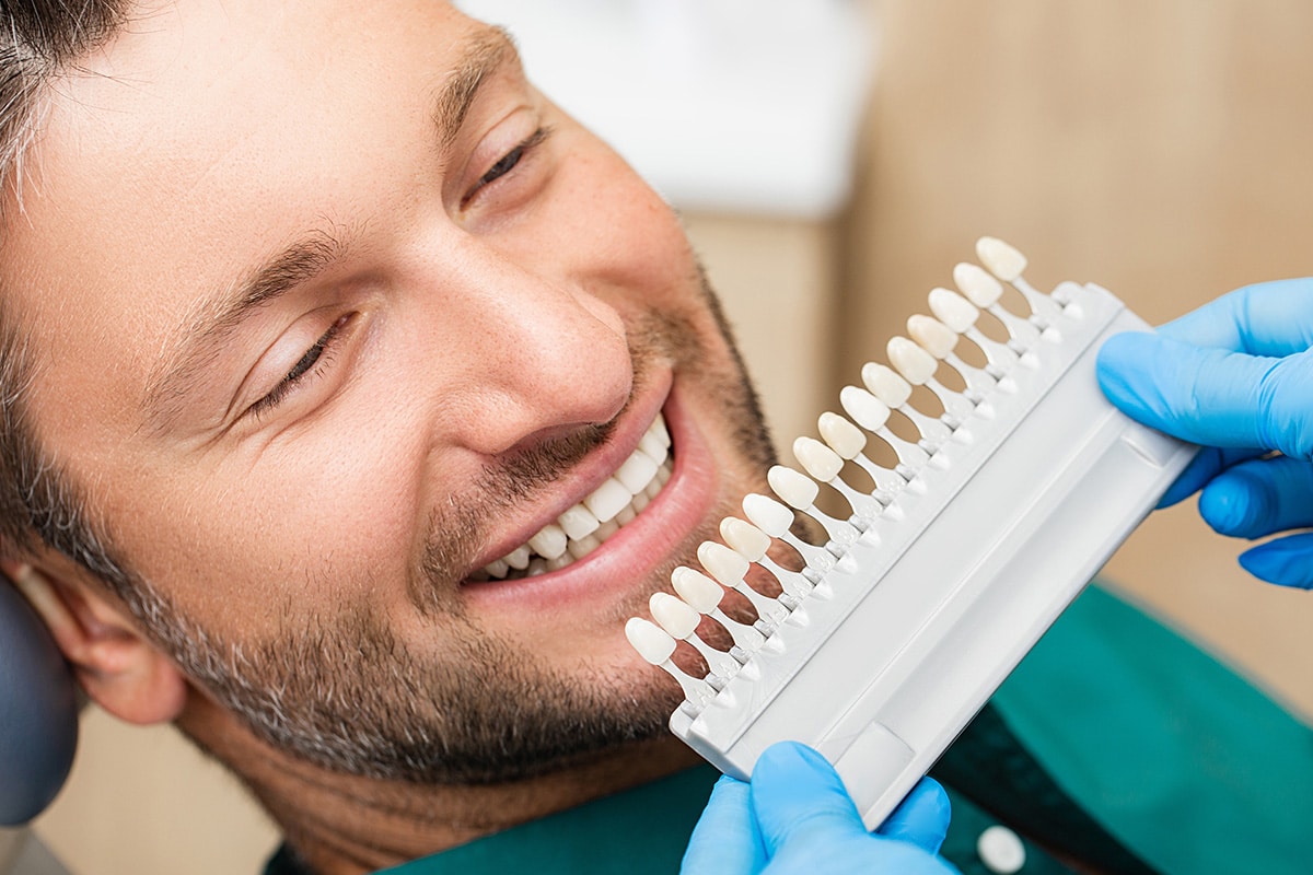 How Much Do Porcelain Veneers Cost in Huntersville, NC?