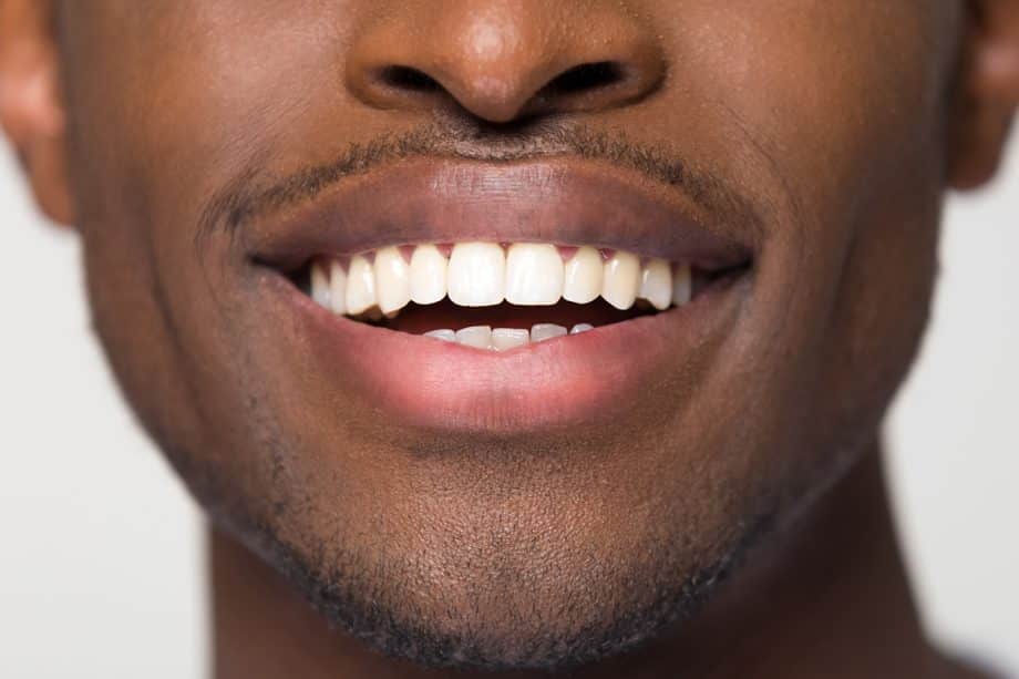 How Does Teeth Whitening Work?