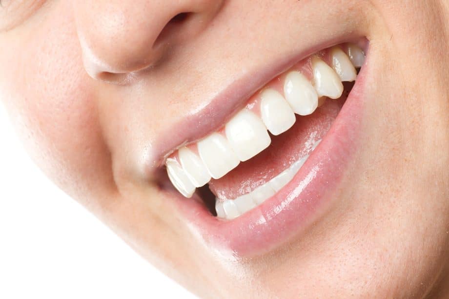 How Long Do Dental Veneers Last? | The Smile Architects