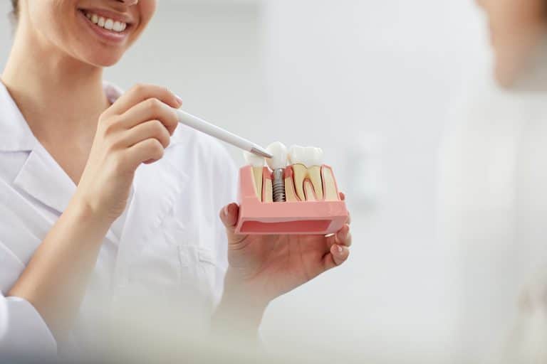 How Quickly Do Dental Implants Take to Heal? Huntersville, NC