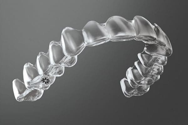 Invisalign Aligner Photo