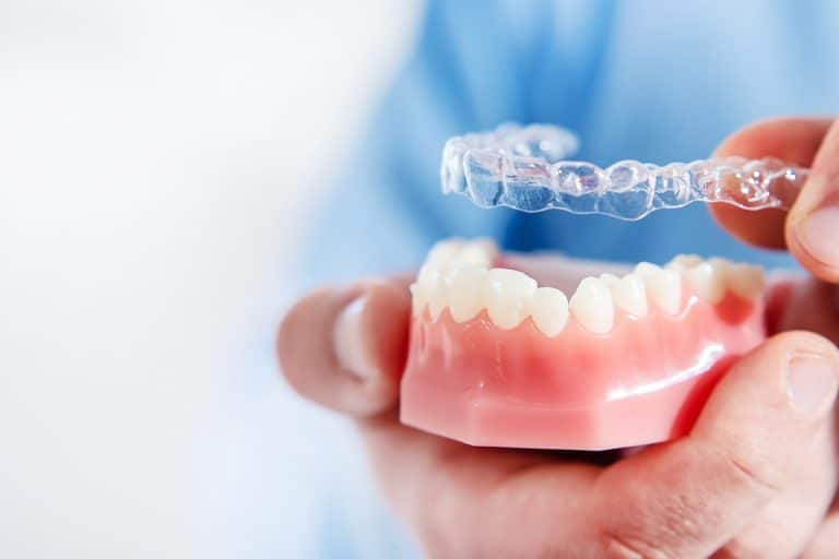 Is Invisalign Worth It? Huntersville, NC Smile Architects