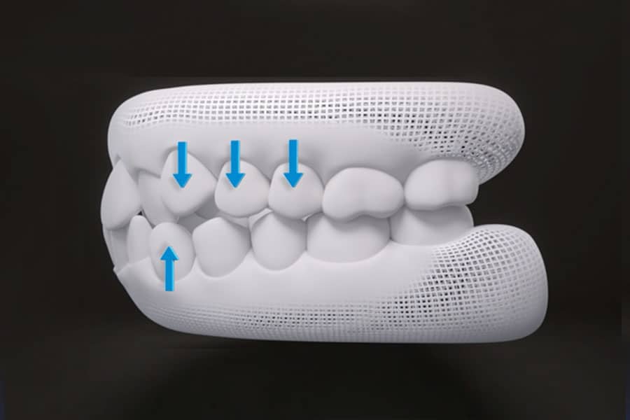 Photo of Treatment Planning