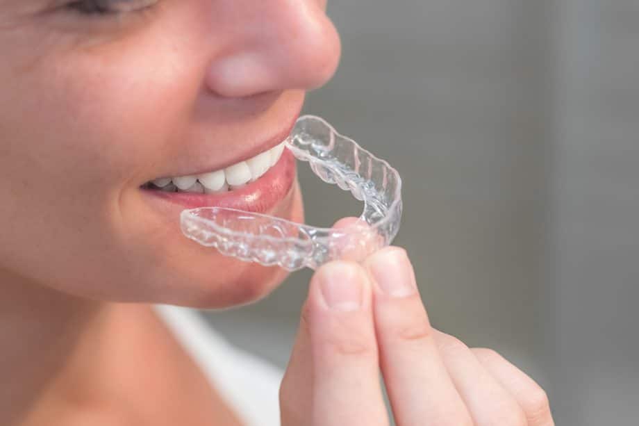 What Happens If You Don’t Wear Your Invisalign for a Few Days?